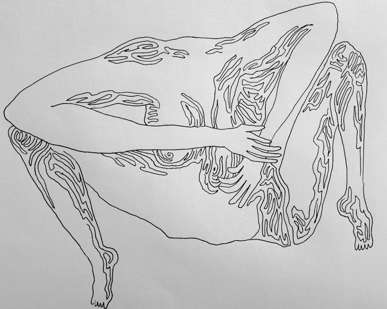 DISTORSIONI